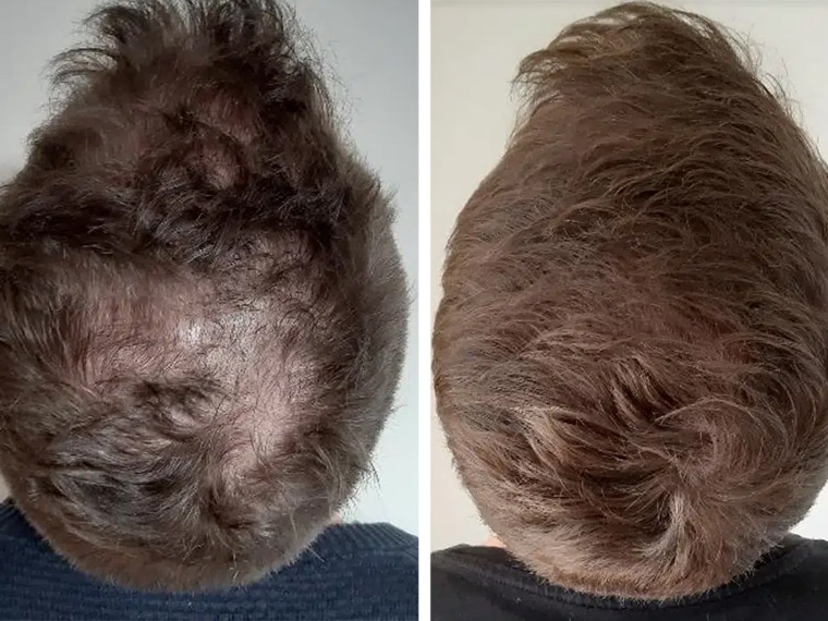 5 Før & efter