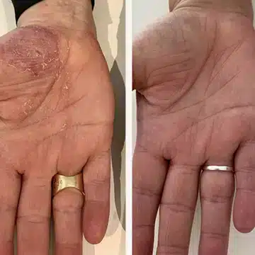 Eksem 29.jpg Eksem 29.jpg