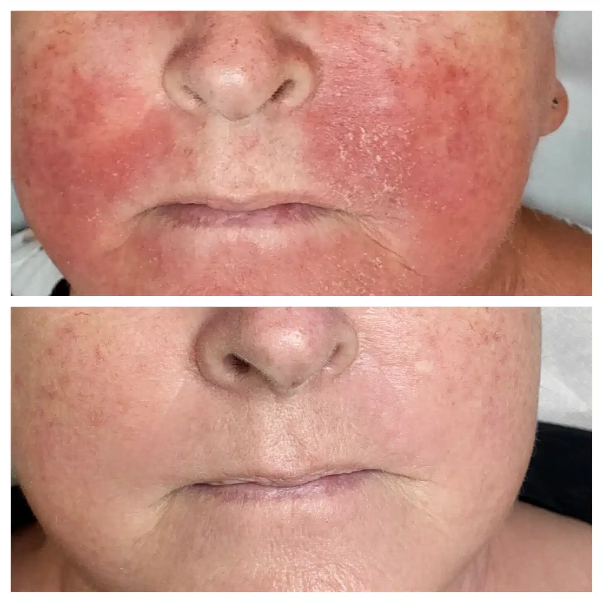 Eksem 31 2048x2048.png Eksem 31 2048x2048.png