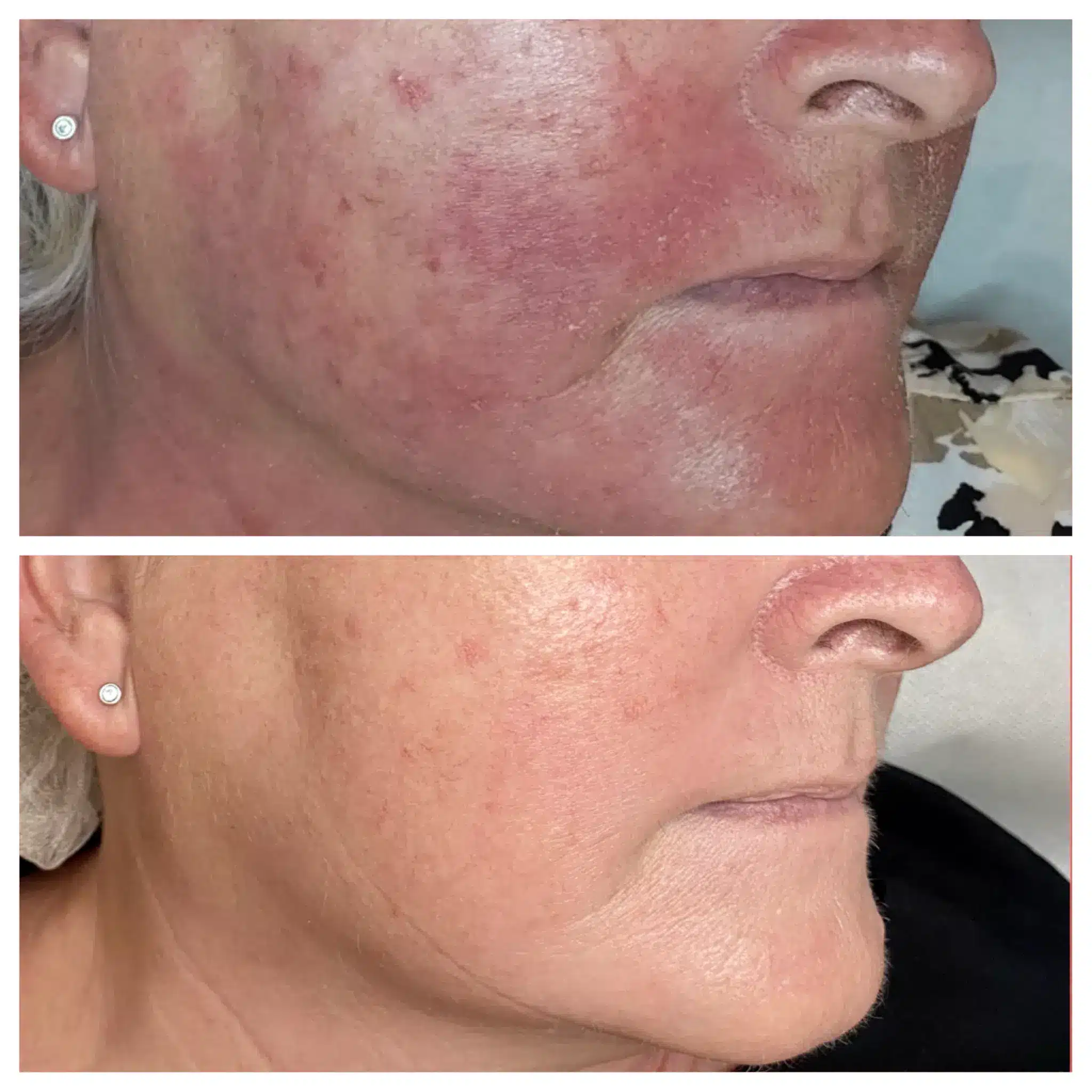 eksem 32 2048x2048.png eksem 32 2048x2048.png